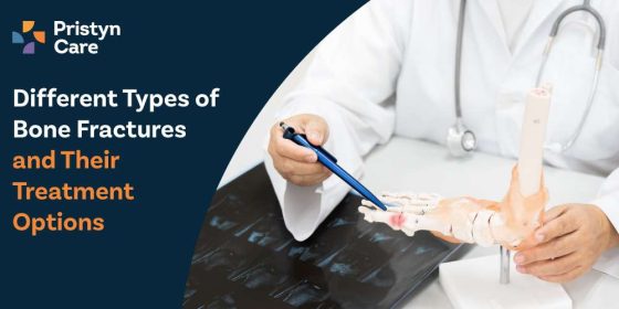 Different Types of Bone Fractures and Their Treatment Options - Pristyn ...