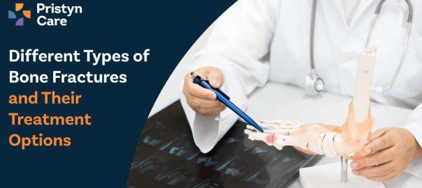 Different Types of Bone Fractures and Their Treatment Options