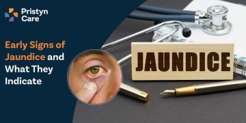 Early-Signs-of-Jaundice-and-What-They-Indicate