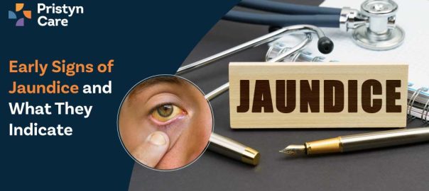 Early Signs of Jaundice and What They Indicate