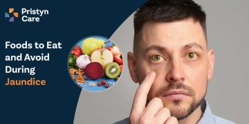 Foods to Eat and Avoid During Jaundice