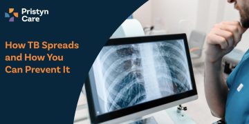How-TB-Spreads-and-How-You-Can-Prevent