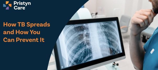 How TB Spreads and How You Can Prevent It