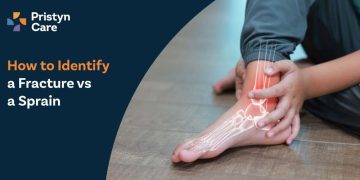 How-to-Identify-a-Fracture-vs-a-Sprain