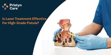 Is-Laser-Treatment-Effective-for-High-Grade-Fistula