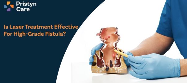 Is Laser Treatment Effective for High-Grade Fistula?