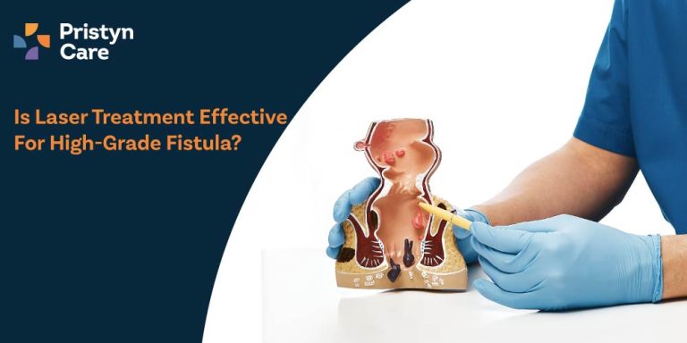 Is-Laser-Treatment-Effective-for-High-Grade-Fistula
