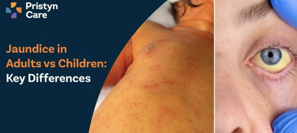 Jaundice in Adults vs Children: Key Differences