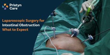 Laparoscopic-Surgery-for--Intestinal-Obstruction--What-to-Expect