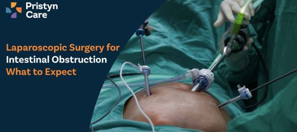 Laparoscopic Surgery for Intestinal Obstruction – What to Expect