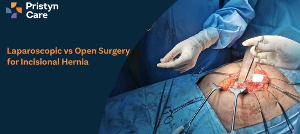 Laparoscopic vs Open Surgery for Incisional Hernia