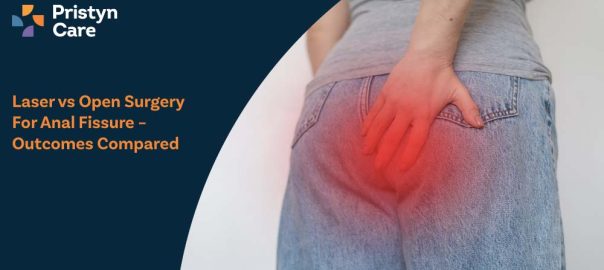 Laser vs Open Surgery for Anal Fissure – Outcomes Compared