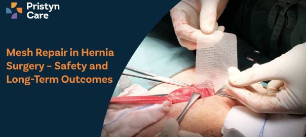 Mesh Repair in Hernia Surgery – Safety and Long-Term Outcomes