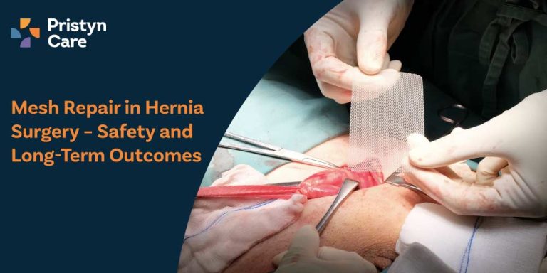 Mesh Repair in Hernia Surgery – Safety and Long-Term Outcomes