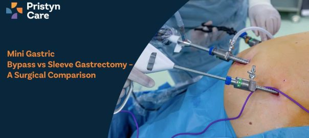 Mini Gastric Bypass vs Sleeve Gastrectomy – A Surgical Comparison
