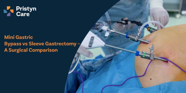 Mini Gastric Bypass vs Sleeve Gastrectomy – A Surgical Comparison