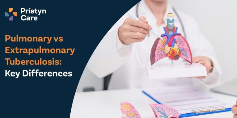 Pulmonary-vs-Extrapulmonary-Tuberculosis--Key-Differences