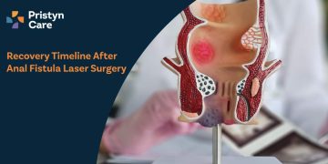 Recovery-Timeline-After-Anal-Fistula-Laser-Surgery