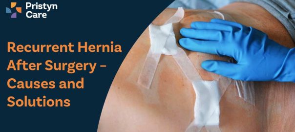 Recurrent Hernia After Surgery – Causes and Solutions