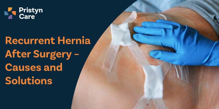 Recurrent Hernia After Surgery – Causes and Solutions