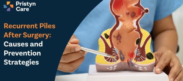 Recurrent Piles After Surgery – Causes and Prevention Strategies
