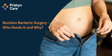 Revision Bariatric Surgery – Who Needs It and Why?