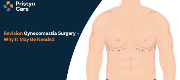 Revision Gynecomastia Surgery – Why It May Be Needed