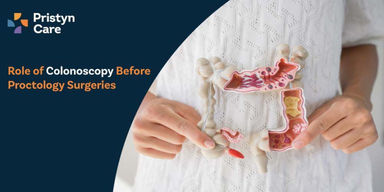 Role-of-Colonoscopy-Before-Proctology-Surgeries