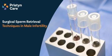 Surgical Sperm Retrieval Techniques in Male Infertility
