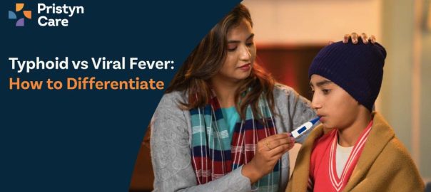 Typhoid vs Viral Fever: How to Differentiate