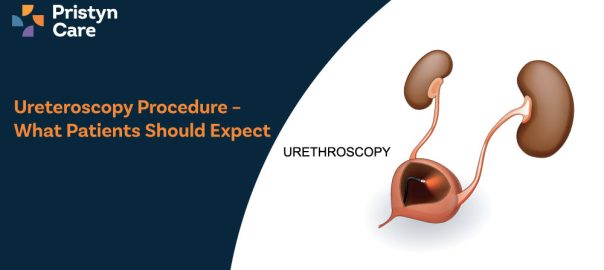 Ureteroscopy Procedure – What Patients Should Expect