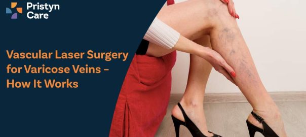 Vascular Laser Surgery for Varicose Veins – How It Works