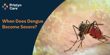 When-Does-Dengue-Become-Severe