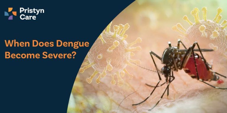 When-Does-Dengue-Become-Severe