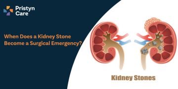 When Does a Kidney Stone Become a Surgical Emergency?