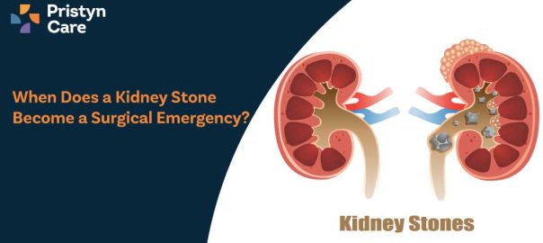 When Does a Kidney Stone Become a Surgical Emergency?