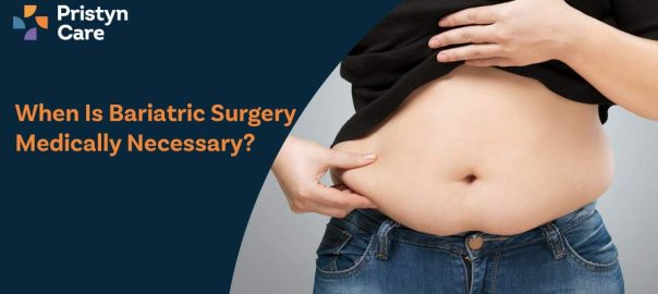 When Is Bariatric Surgery Medically Necessary?