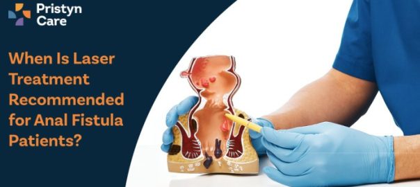 When Is Laser Treatment Recommended for Anal Fistula Patients?