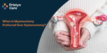 When Is Myomectomy Preferred Over Hysterectomy?