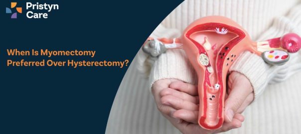 When Is Myomectomy Preferred Over Hysterectomy?