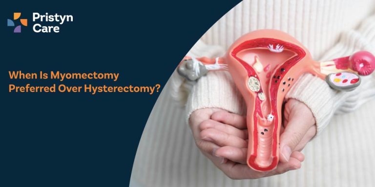 When Is Myomectomy Preferred Over Hysterectomy?