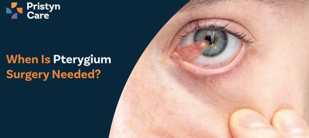 When Is Pterygium Surgery Needed?