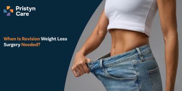 When Is Revision Weight Loss Surgery Needed?