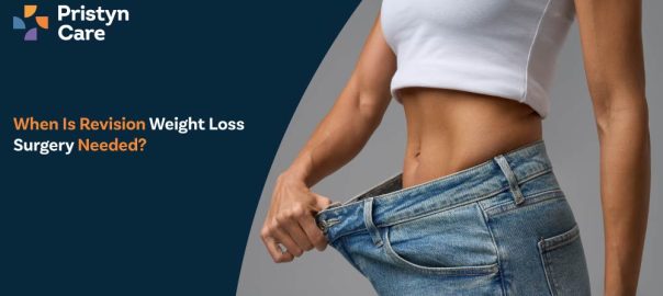 When Is Revision Weight Loss Surgery Needed?