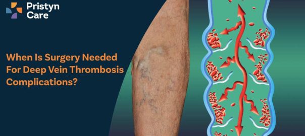 When Is Surgery Needed for Deep Vein Thrombosis Complications?