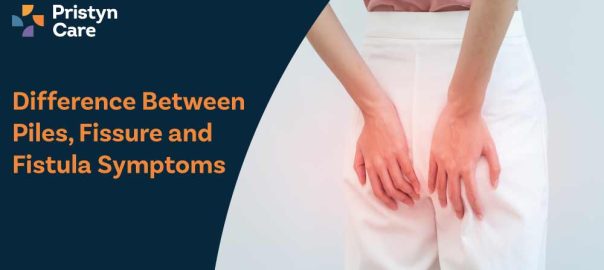 Difference Between Piles, Fissure and Fistula Symptoms