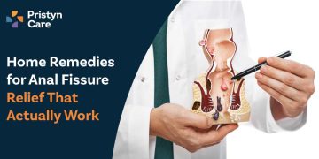 Home Remedies for Anal Fissure Relief That Actually Work