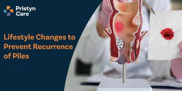 Lifestyle-Changes-to-Prevent-Recurrence-of-Piles