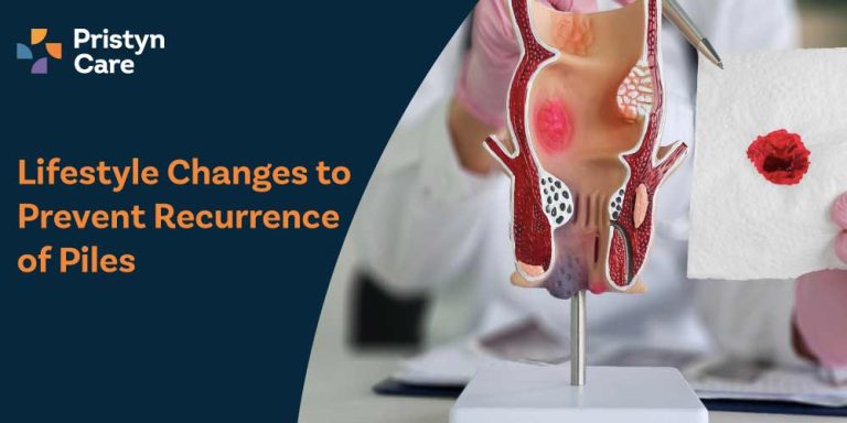 Lifestyle-Changes-to-Prevent-Recurrence-of-Piles
