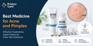 Best Medicine for Acne and Pimples